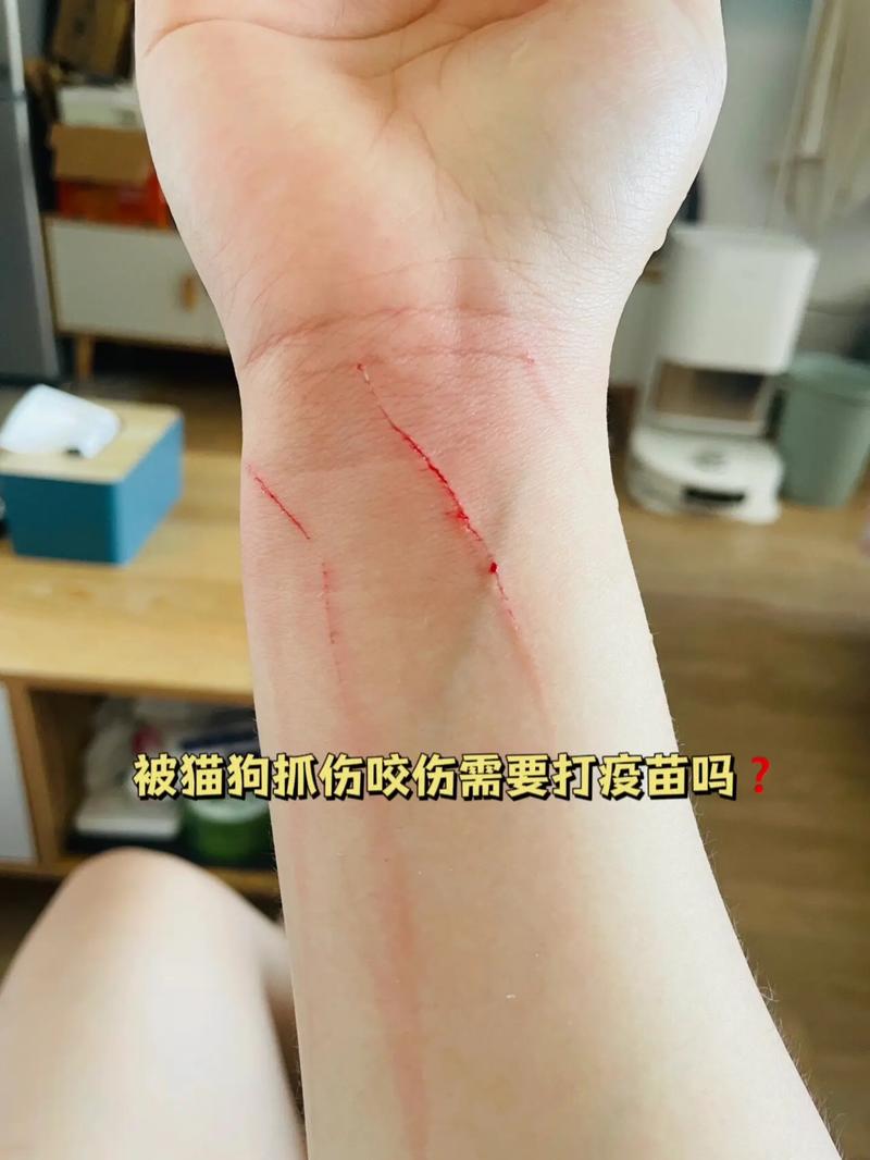 猫猫抓了要不要打疫苗,猫咪抓了需要打针吗-第5张图片-后鲨宠物 猫猫抓了要不要打疫苗,猫咪抓了需要打针吗-第5张图片-后鲨宠物