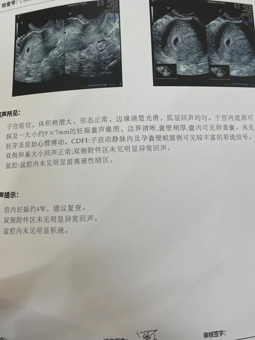 狗狗怀孕二十天的症状,狗狗怀孕二十一天什么表现?-第5张图片-后鲨宠物 狗狗怀孕二十天的症状,狗狗怀孕二十一天什么表现?-第5张图片-后鲨宠物