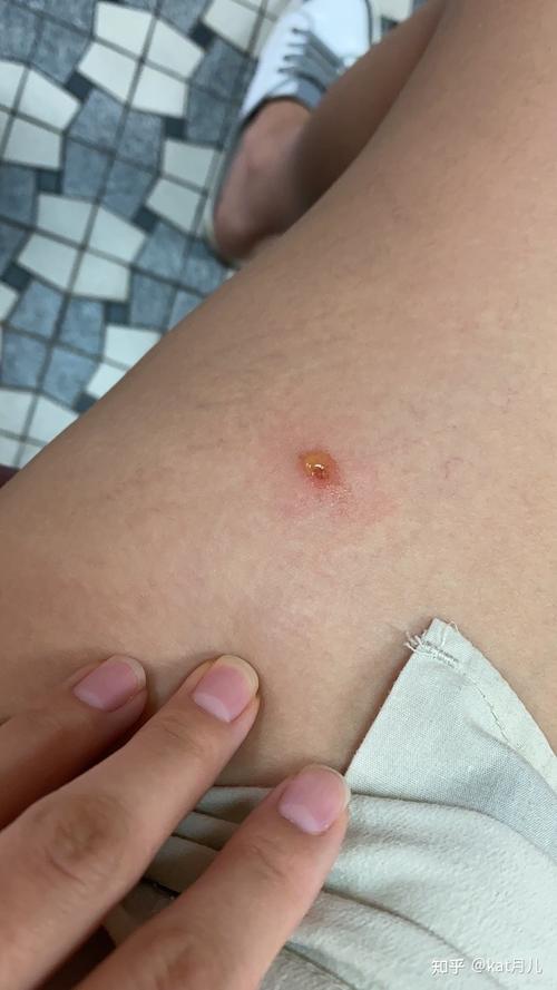 猫咪奶藓多久能好,猫咪奶藓多久能好啊?-第4张图片-后鲨宠物 猫咪奶藓多久能好,猫咪奶藓多久能好啊?-第4张图片-后鲨宠物