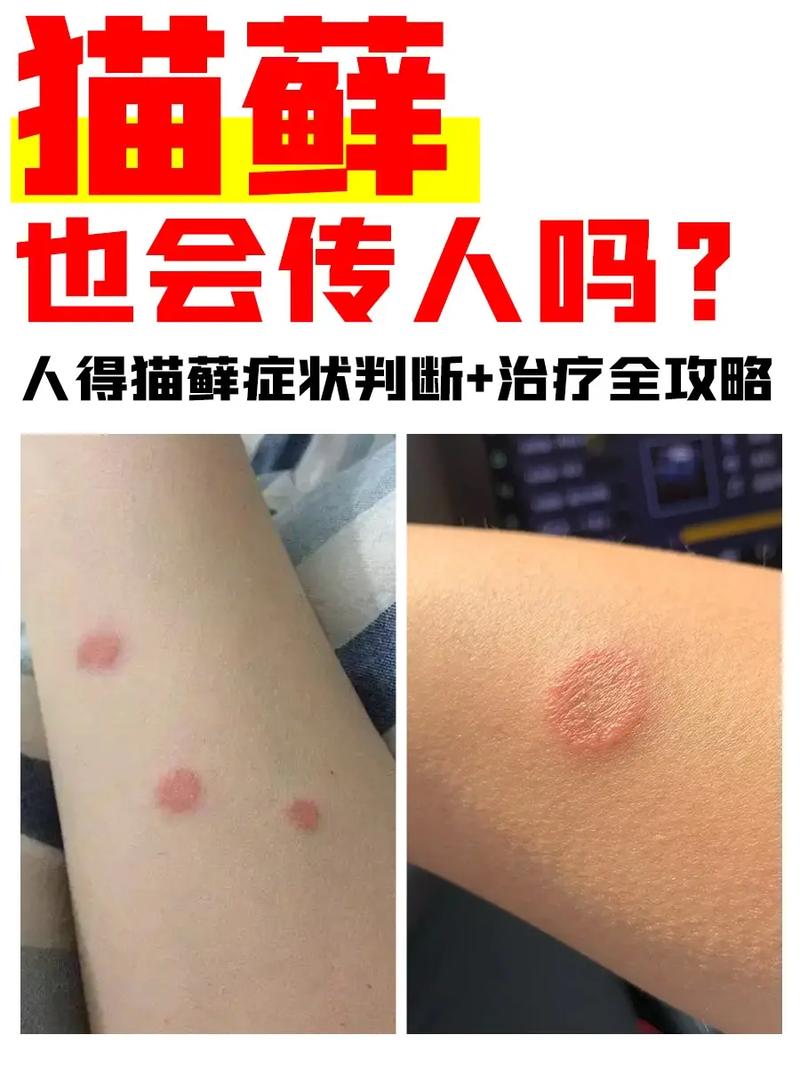 猫咪猫癣怎么治_猫咪猫癣怎么治好得快-第2张图片-后鲨宠物 猫咪猫癣怎么治_猫咪猫癣怎么治好得快-第2张图片-后鲨宠物