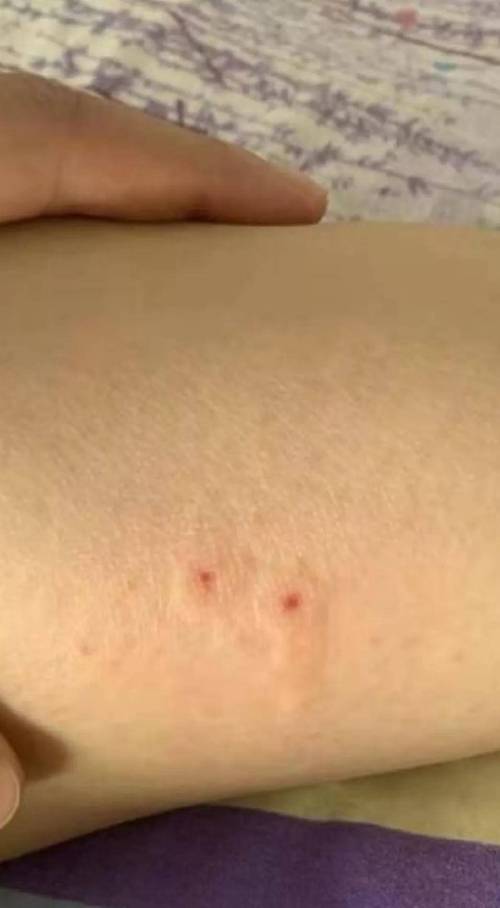 狗狗被蛇咬了怎么办,狗狗被蛇咬了怎么办,消肿止痛酊有没有用-第3张图片-后鲨宠物 狗狗被蛇咬了怎么办,狗狗被蛇咬了怎么办,消肿止痛酊有没有用-第3张图片-后鲨宠物