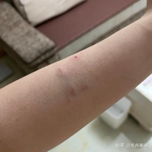 被自己的猫咪咬出血了,被自己的猫咬伤了?-第2张图片-后鲨宠物 被自己的猫咪咬出血了,被自己的猫咬伤了?-第2张图片-后鲨宠物