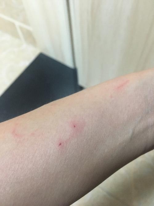 被自己的猫咪咬出血了,被自己的猫咬伤了?-第3张图片-后鲨宠物 被自己的猫咪咬出血了,被自己的猫咬伤了?-第3张图片-后鲨宠物