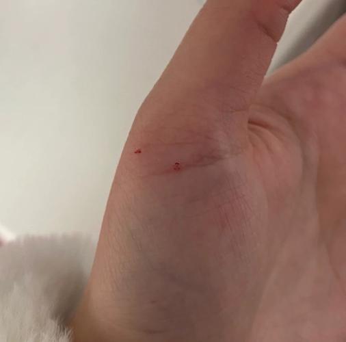 被自己的猫咪咬出血了,被自己的猫咬伤了?-第4张图片-后鲨宠物 被自己的猫咪咬出血了,被自己的猫咬伤了?-第4张图片-后鲨宠物