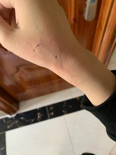 被自己的猫咪咬出血了,被自己的猫咬伤了?-第6张图片-后鲨宠物 被自己的猫咪咬出血了,被自己的猫咬伤了?-第6张图片-后鲨宠物