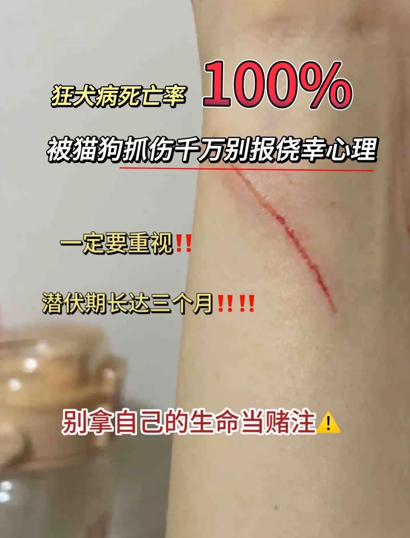 被自家狗狗抓伤要不要打针,被自家狗狗抓了一下!!!!求助!-第3张图片-后鲨宠物 被自家狗狗抓伤要不要打针,被自家狗狗抓了一下!!!!求助!-第3张图片-后鲨宠物
