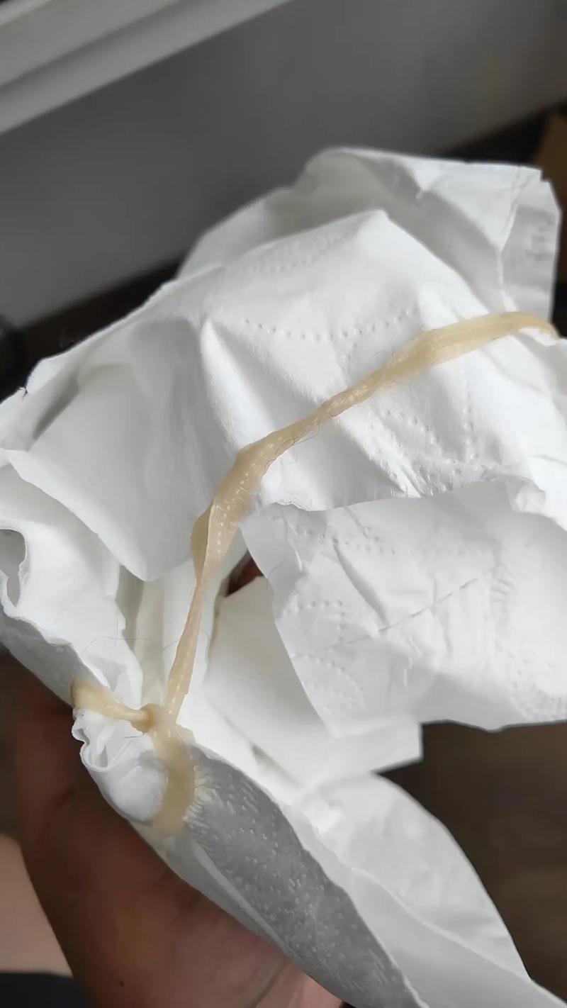 猫咪吐虫子怎么办,猫吐虫子是怎么回事-第5张图片-后鲨宠物 猫咪吐虫子怎么办,猫吐虫子是怎么回事-第5张图片-后鲨宠物