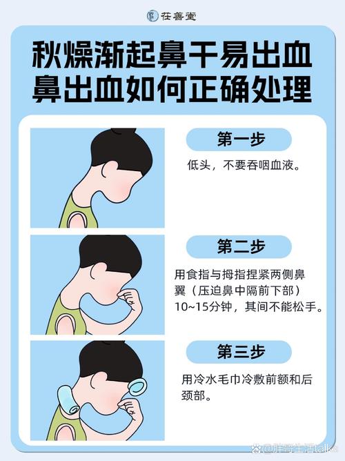 狗狗流鼻血怎么回事,狗狗流鼻血是怎么了?-第4张图片-后鲨宠物 狗狗流鼻血怎么回事,狗狗流鼻血是怎么了?-第4张图片-后鲨宠物