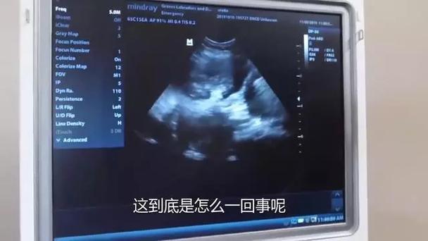 猫咪做b超多少钱,猫咪做b超费用-第6张图片-后鲨宠物 猫咪做b超多少钱,猫咪做b超费用-第6张图片-后鲨宠物