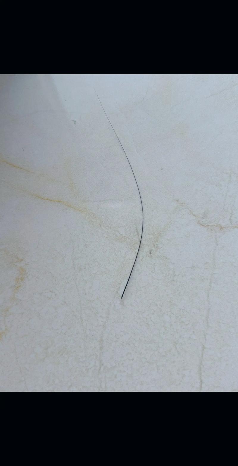  猫咪掉胡子是什么原因，猫掉胡子是什么情况