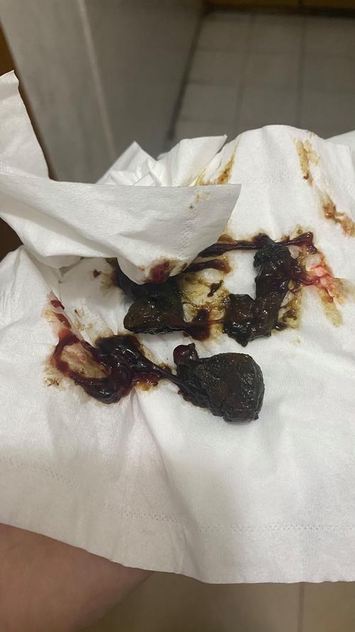 狗狗拉黑屎什么原因,狗狗拉黑屎正常吗?-第3张图片-后鲨宠物 狗狗拉黑屎什么原因,狗狗拉黑屎正常吗?-第3张图片-后鲨宠物