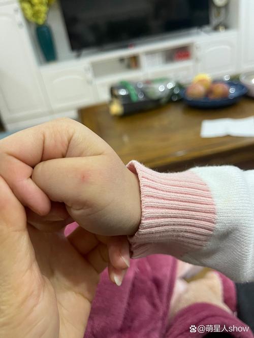 狗狗可以舔伤口吗_狗狗可以舔伤口吗图片-第2张图片-后鲨宠物 狗狗可以舔伤口吗_狗狗可以舔伤口吗图片-第2张图片-后鲨宠物