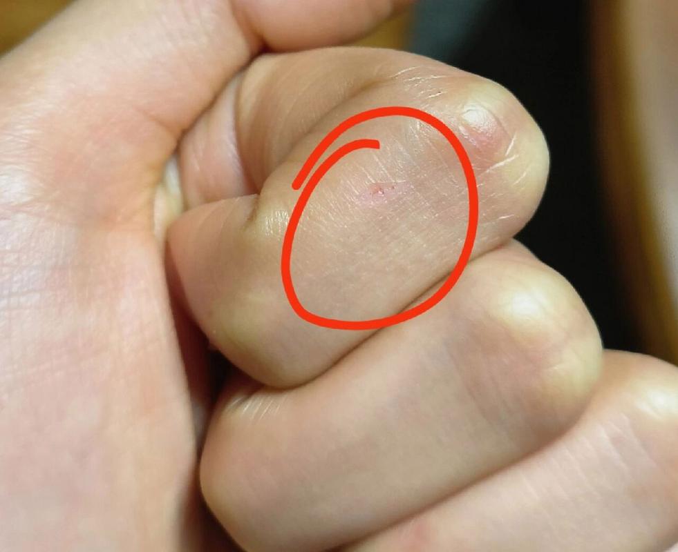 狗狗可以舔伤口吗_狗狗可以舔伤口吗图片-第5张图片-后鲨宠物 狗狗可以舔伤口吗_狗狗可以舔伤口吗图片-第5张图片-后鲨宠物