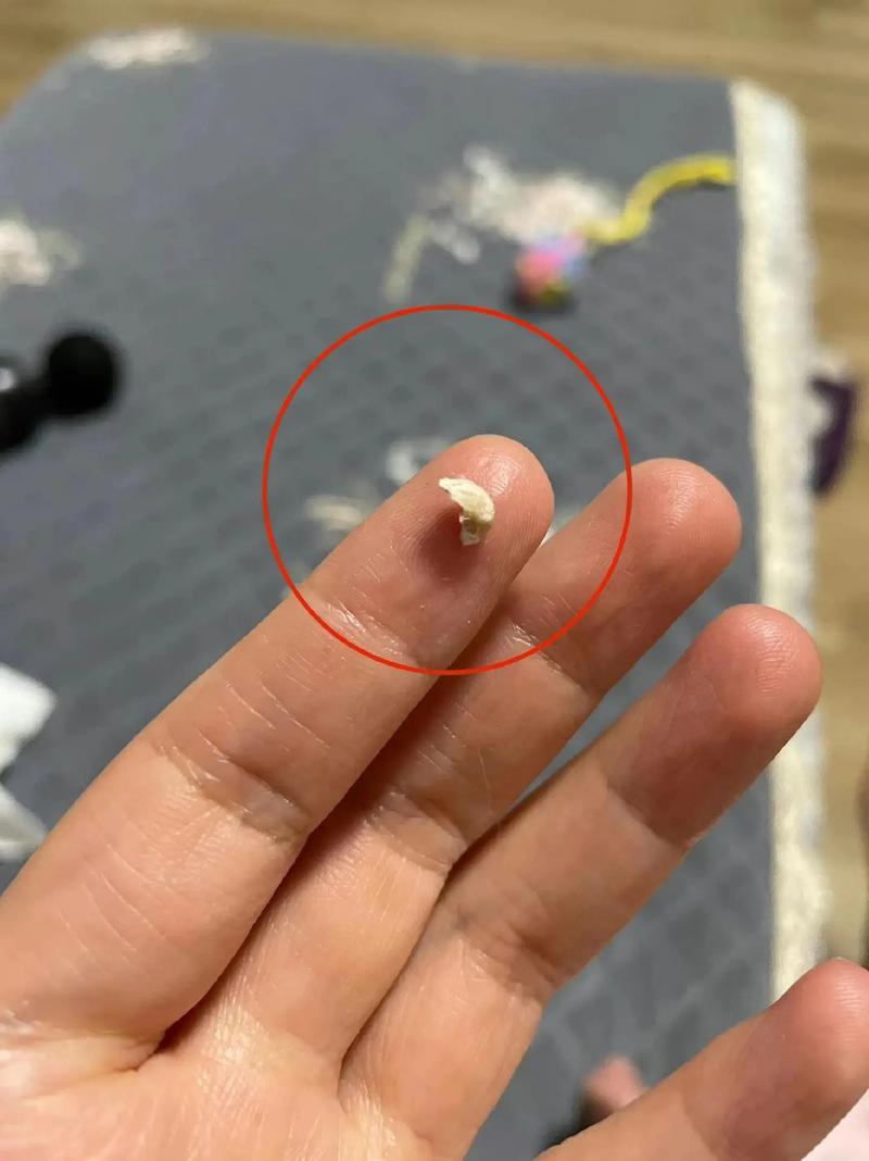 猫咪结石手术多少钱,猫咪结石手术多少钱一次-第4张图片-后鲨宠物 猫咪结石手术多少钱,猫咪结石手术多少钱一次-第4张图片-后鲨宠物