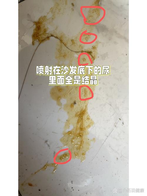 猫咪结石手术多少钱,猫咪结石手术多少钱一次-第5张图片-后鲨宠物 猫咪结石手术多少钱,猫咪结石手术多少钱一次-第5张图片-后鲨宠物