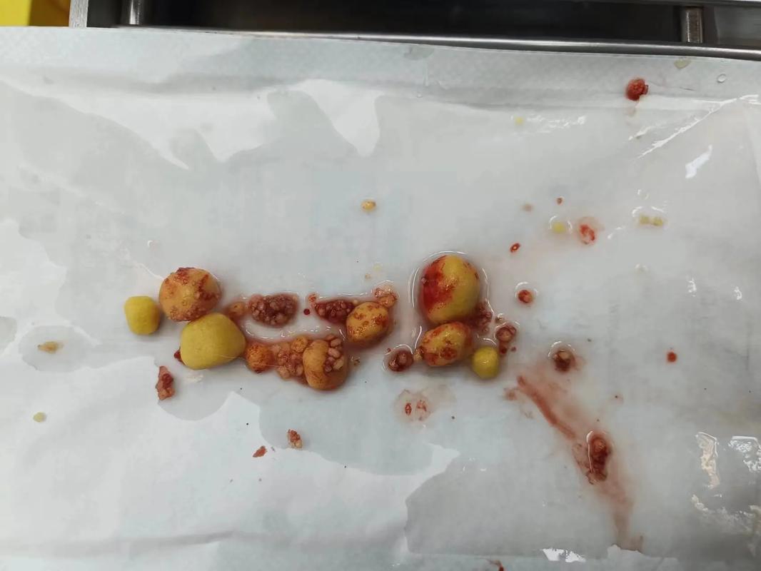 狗狗膀胱结石术后护理，狗膀胱结石术后饮食菜谱？