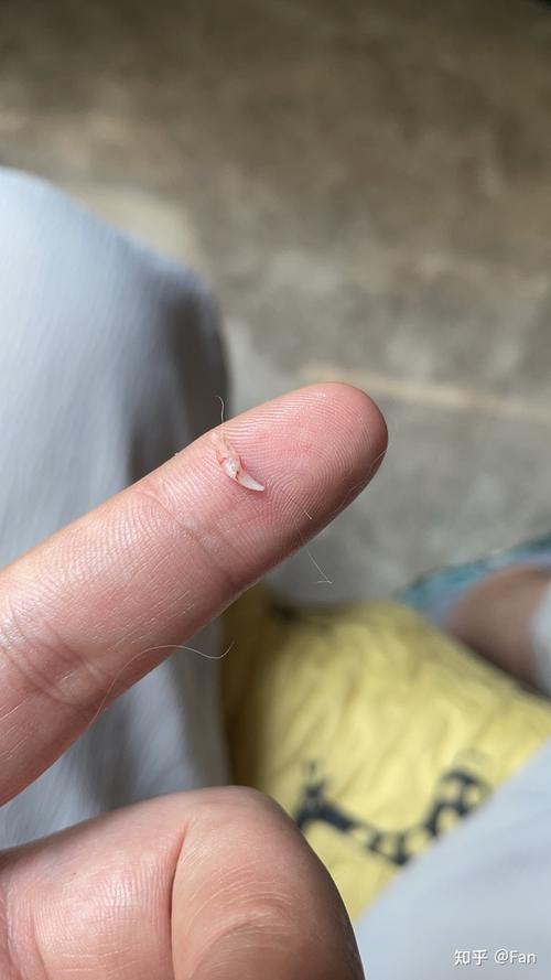 猫咪掉牙齿是怎么回事_猫咪掉牙正常吗-第2张图片-后鲨宠物 猫咪掉牙齿是怎么回事_猫咪掉牙正常吗-第2张图片-后鲨宠物