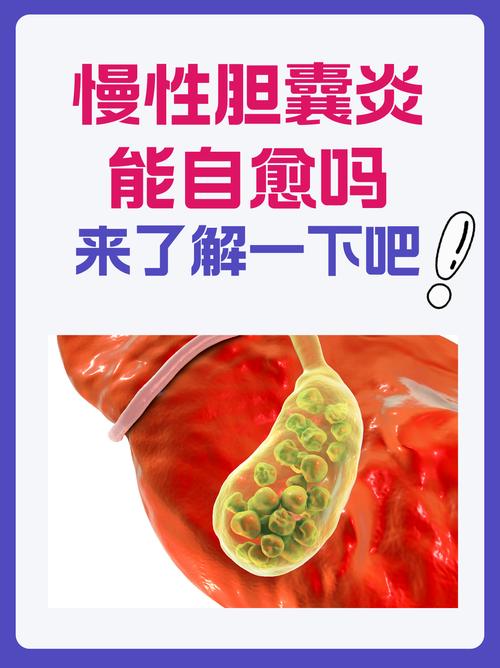  猫咪胆囊炎有哪些症状，猫咪胆囊炎的症状