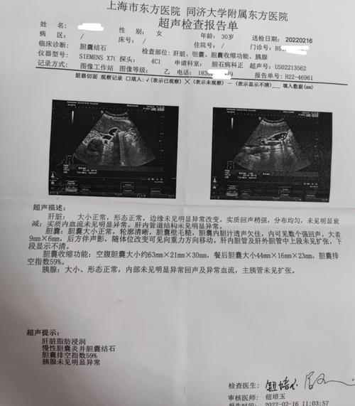 猫咪胆囊炎有哪些症状,猫咪胆囊炎的症状-第5张图片-后鲨宠物 猫咪胆囊炎有哪些症状,猫咪胆囊炎的症状-第5张图片-后鲨宠物