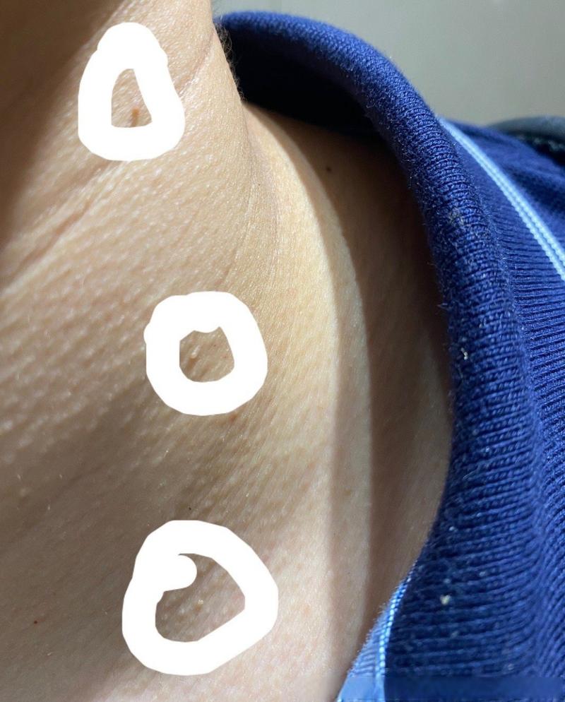 猫咪脖子疙瘩是淋巴吗,猫咪脖子摸着疙疙瘩瘩的咋回事-第2张图片-后鲨宠物 猫咪脖子疙瘩是淋巴吗,猫咪脖子摸着疙疙瘩瘩的咋回事-第2张图片-后鲨宠物