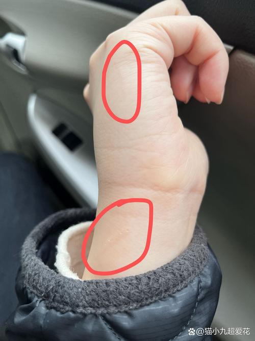 被猫咪抓伤了要打针吗,被猫咪抓了用不用打针疫苗-第2张图片-后鲨宠物 被猫咪抓伤了要打针吗,被猫咪抓了用不用打针疫苗-第2张图片-后鲨宠物