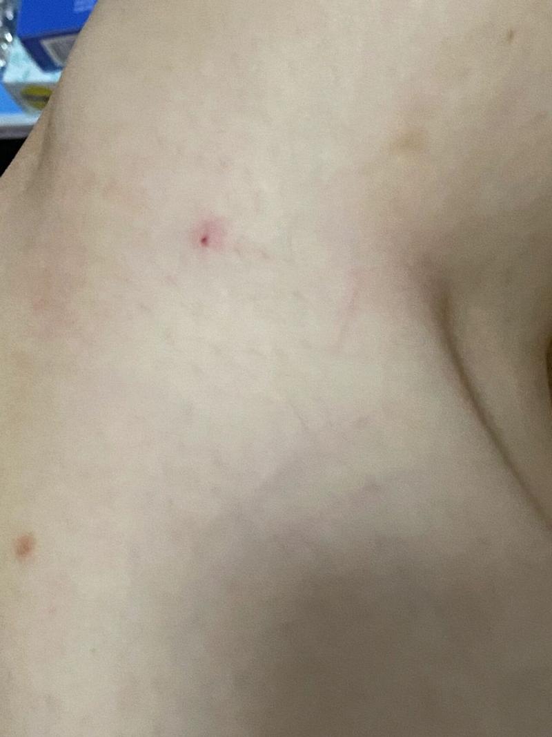 被猫咪抓伤了要打针吗,被猫咪抓了用不用打针疫苗-第3张图片-后鲨宠物 被猫咪抓伤了要打针吗,被猫咪抓了用不用打针疫苗-第3张图片-后鲨宠物