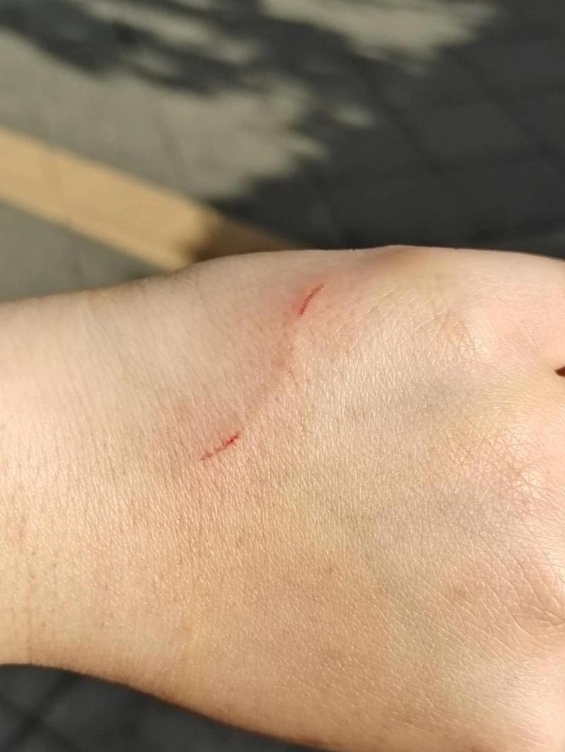 被猫咪抓伤了要打针吗,被猫咪抓了用不用打针疫苗-第4张图片-后鲨宠物 被猫咪抓伤了要打针吗,被猫咪抓了用不用打针疫苗-第4张图片-后鲨宠物