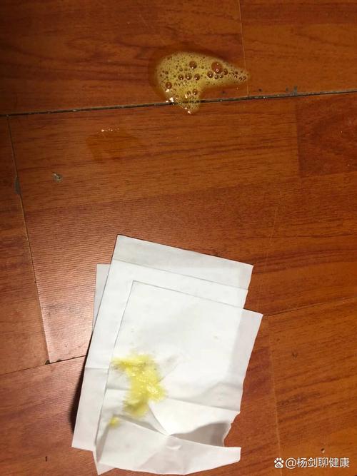 猫咪呕吐黄水不吃东西_猫咪呕吐黄水不吃东西只喝水