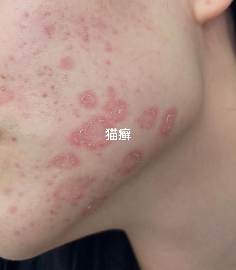 猫咪过敏性皮炎,猫咪过敏性皮炎能治愈吗-第2张图片-后鲨宠物 猫咪过敏性皮炎,猫咪过敏性皮炎能治愈吗-第2张图片-后鲨宠物