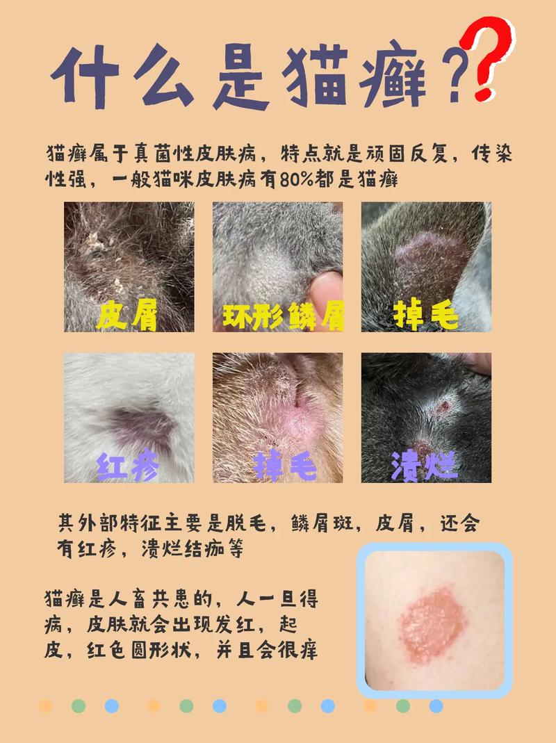 猫咪身上有猫癣怎么办_猫咪身上的猫藓怎么治-第5张图片-后鲨宠物 猫咪身上有猫癣怎么办_猫咪身上的猫藓怎么治-第5张图片-后鲨宠物