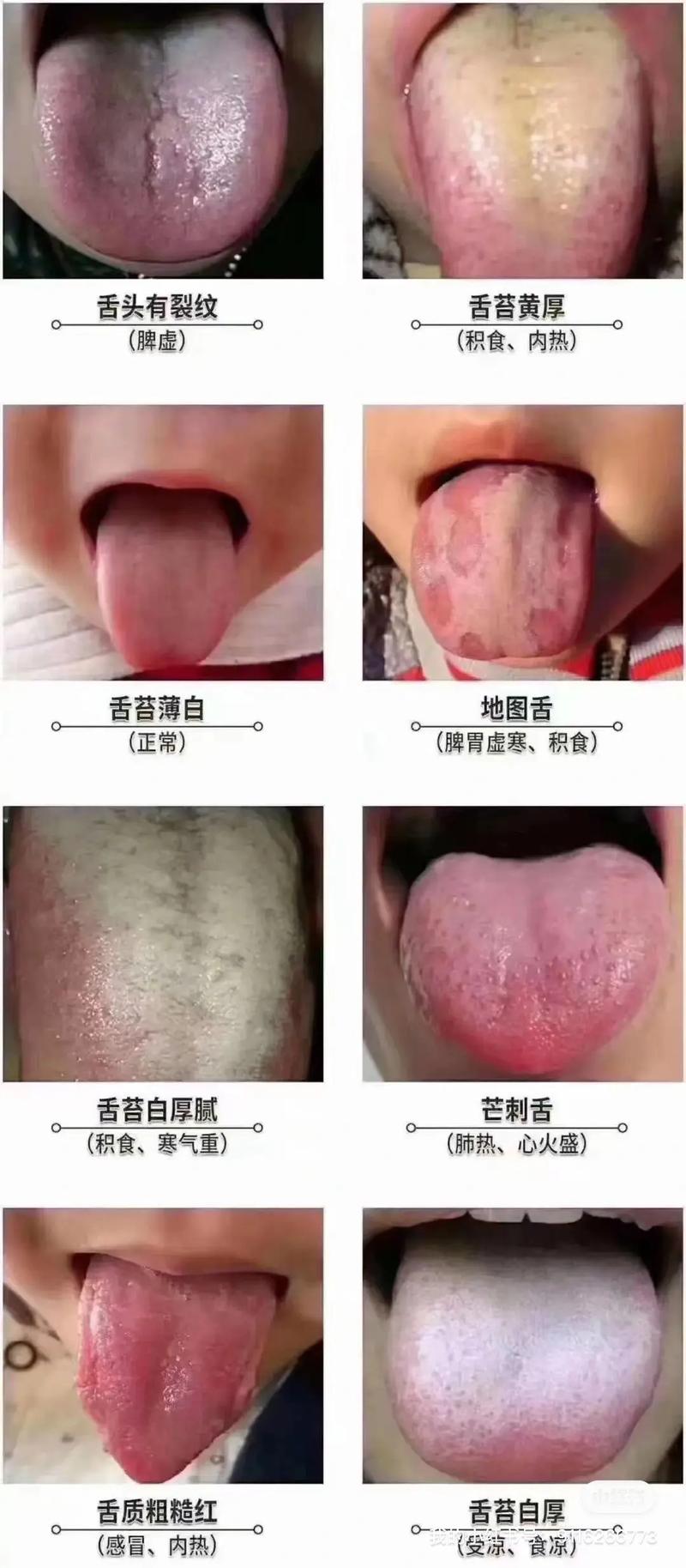 狗狗舌头发白怎么办,狗狗舌头发白怎么办吃什么药-第2张图片-后鲨宠物 狗狗舌头发白怎么办,狗狗舌头发白怎么办吃什么药-第2张图片-后鲨宠物