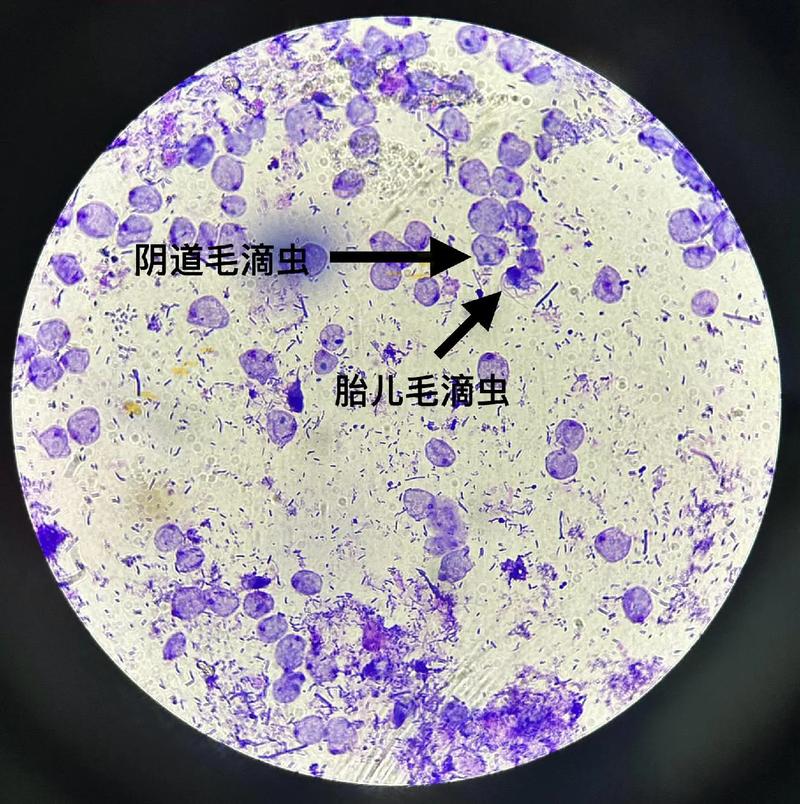 狗狗滴虫会传染给人吗,狗感染滴虫主人可能感染吗-第6张图片-后鲨宠物 狗狗滴虫会传染给人吗,狗感染滴虫主人可能感染吗-第6张图片-后鲨宠物