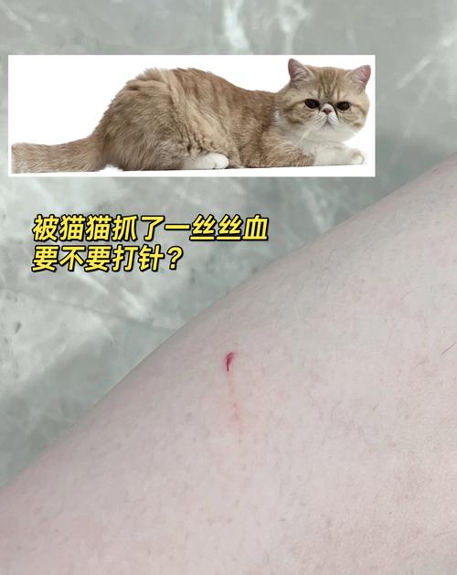 被猫咪抓出血了要打针吗,被猫咪抓出血了怎么处理-第2张图片-后鲨宠物 被猫咪抓出血了要打针吗,被猫咪抓出血了怎么处理-第2张图片-后鲨宠物