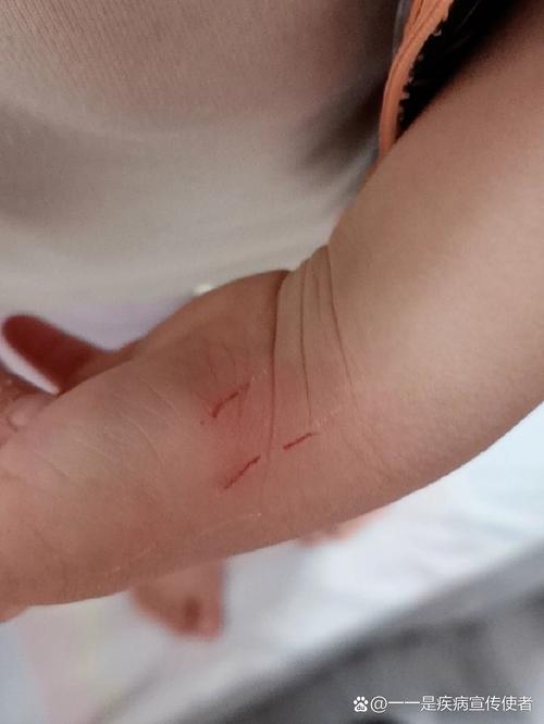 被猫咪抓出血了要打针吗,被猫咪抓出血了怎么处理-第3张图片-后鲨宠物 被猫咪抓出血了要打针吗,被猫咪抓出血了怎么处理-第3张图片-后鲨宠物