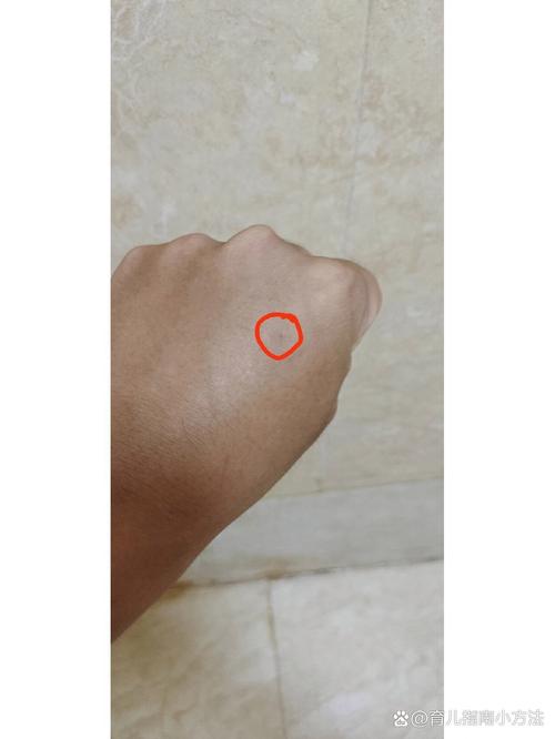 被猫咪抓出血了要打针吗,被猫咪抓出血了怎么处理-第4张图片-后鲨宠物 被猫咪抓出血了要打针吗,被猫咪抓出血了怎么处理-第4张图片-后鲨宠物