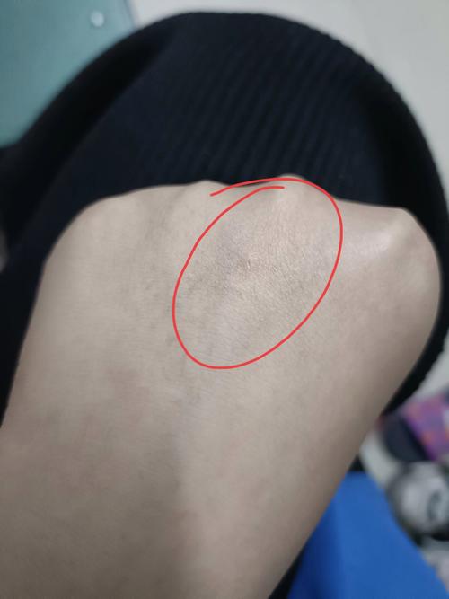 被猫咪抓出血了要打针吗,被猫咪抓出血了怎么处理-第6张图片-后鲨宠物 被猫咪抓出血了要打针吗,被猫咪抓出血了怎么处理-第6张图片-后鲨宠物