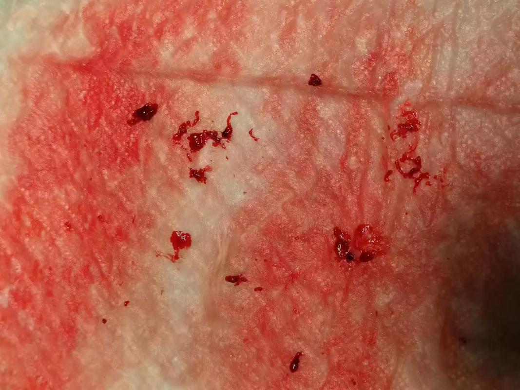 公猫咪尿血是怎么回事_公猫咪尿血咋回事-第1张图片-后鲨宠物 公猫咪尿血是怎么回事_公猫咪尿血咋回事-第1张图片-后鲨宠物