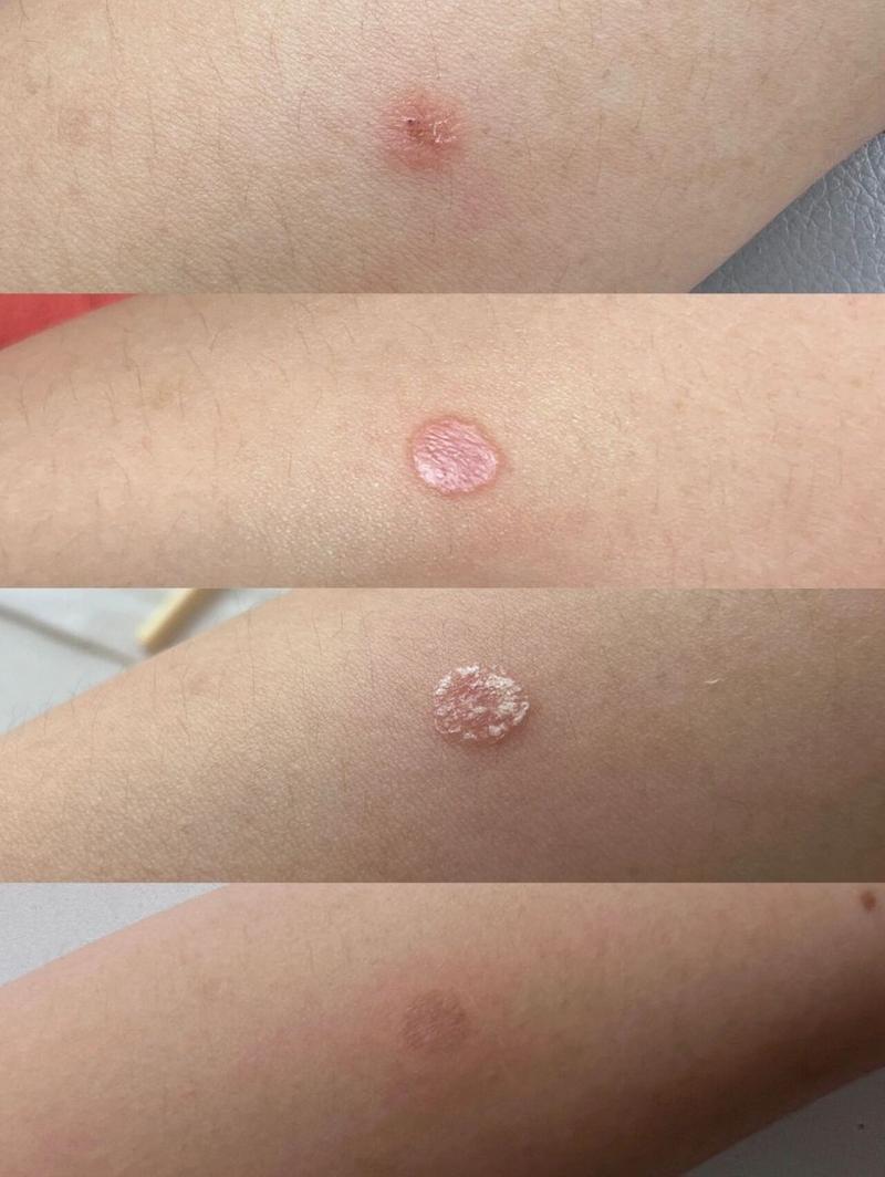 猫咪得猫藓的症状_猫咪得猫藓有什么症状-第4张图片-后鲨宠物 猫咪得猫藓的症状_猫咪得猫藓有什么症状-第4张图片-后鲨宠物