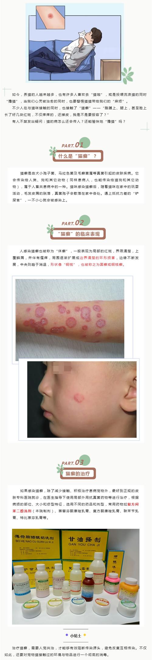 猫咪身上长癣怎么办,猫身上长了癣怎么办?-第3张图片-后鲨宠物 猫咪身上长癣怎么办,猫身上长了癣怎么办?-第3张图片-后鲨宠物