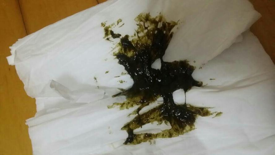 狗狗便便黑色正常吗,狗狗便便黑色正常吗怎么回事?-第6张图片-后鲨宠物 狗狗便便黑色正常吗,狗狗便便黑色正常吗怎么回事?-第6张图片-后鲨宠物