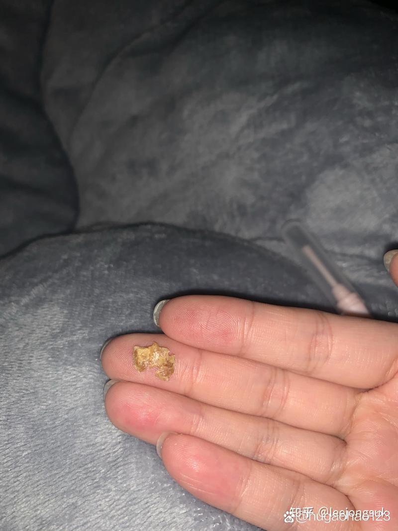 狗狗耳屎怎么清理,狗狗耳朵耳屎怎么处理-第4张图片-后鲨宠物 狗狗耳屎怎么清理,狗狗耳朵耳屎怎么处理-第4张图片-后鲨宠物