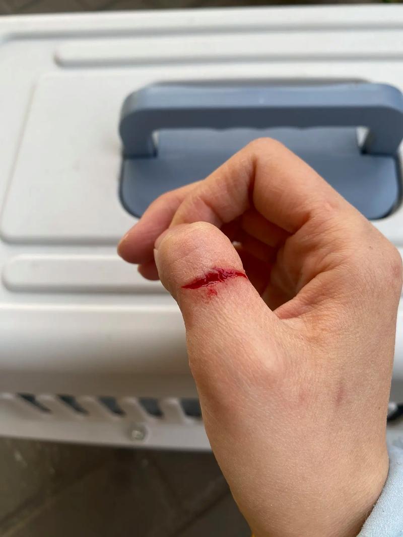 被自己家猫咪咬出血了,被自己家猫咪咬出血了怎么办?-第2张图片-后鲨宠物 被自己家猫咪咬出血了,被自己家猫咪咬出血了怎么办?-第2张图片-后鲨宠物