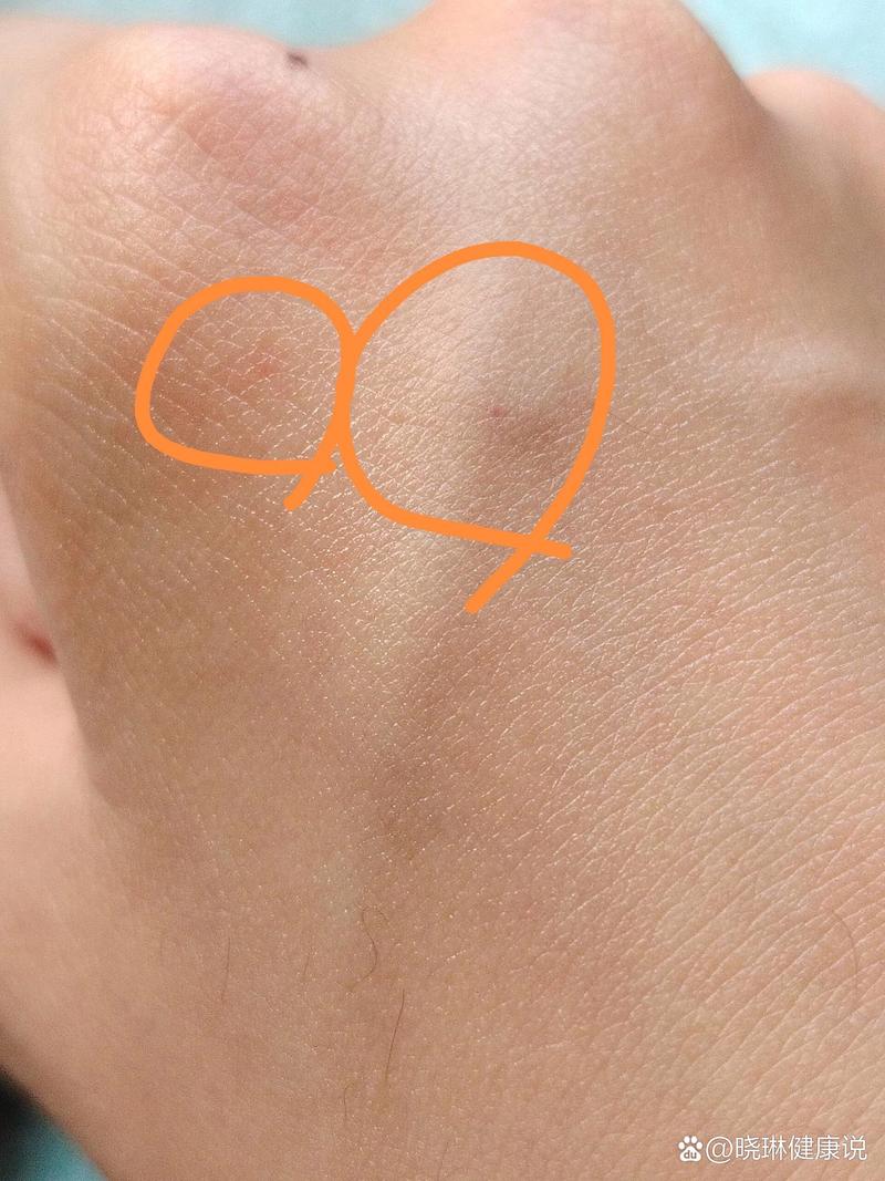 被自己家猫咪咬出血了,被自己家猫咪咬出血了怎么办?-第4张图片-后鲨宠物 被自己家猫咪咬出血了,被自己家猫咪咬出血了怎么办?-第4张图片-后鲨宠物