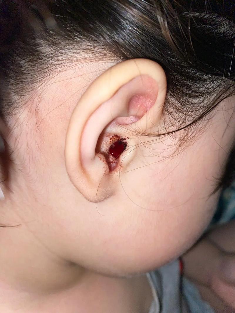 狗狗耳朵出血怎么办,狗狗耳朵出血怎么办吃什么药-第1张图片-后鲨宠物 狗狗耳朵出血怎么办,狗狗耳朵出血怎么办吃什么药-第1张图片-后鲨宠物