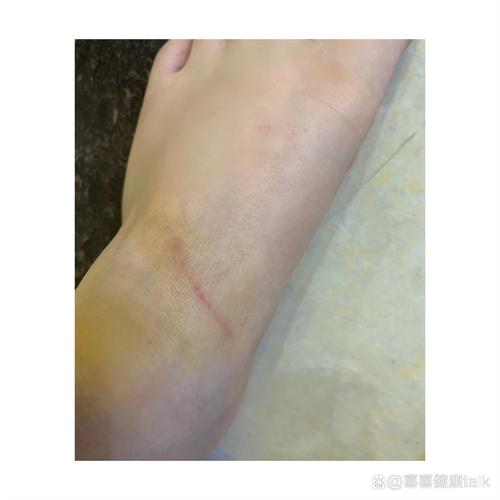 狗狗脚掌划破了怎么办_狗脚掌划开口子怎么治疗-第2张图片-后鲨宠物 狗狗脚掌划破了怎么办_狗脚掌划开口子怎么治疗-第2张图片-后鲨宠物