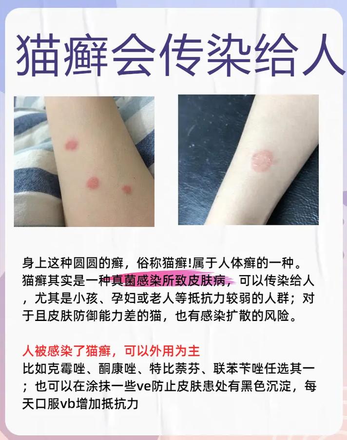 猫咪得了猫藓怎么治疗,猫咪得猫藓怎么处理?-第5张图片-后鲨宠物 猫咪得了猫藓怎么治疗,猫咪得猫藓怎么处理?-第5张图片-后鲨宠物