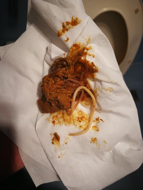 狗狗拉线虫是什么原因,狗狗拉线条虫图片-第3张图片-后鲨宠物 狗狗拉线虫是什么原因,狗狗拉线条虫图片-第3张图片-后鲨宠物