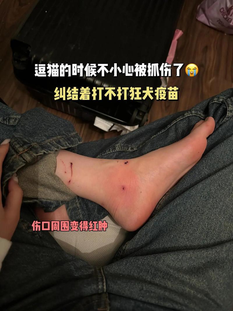 狗狗被猫咬了怎么办_狗狗被猫咬了要打针吗-第1张图片-后鲨宠物 狗狗被猫咬了怎么办_狗狗被猫咬了要打针吗-第1张图片-后鲨宠物