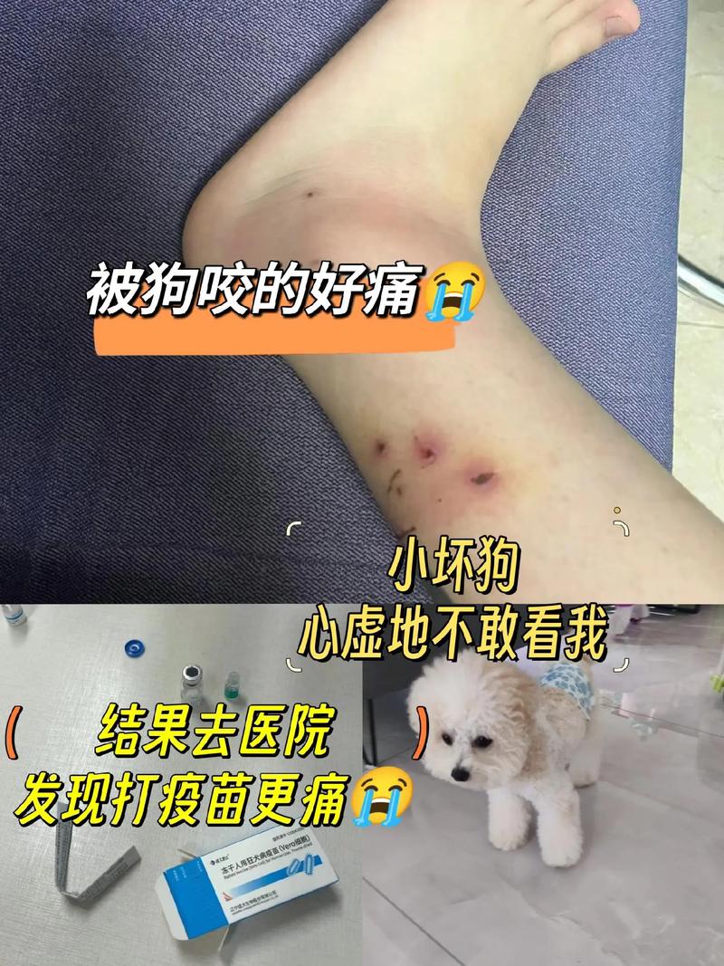 狗狗被猫咬了怎么办_狗狗被猫咬了要打针吗-第4张图片-后鲨宠物 狗狗被猫咬了怎么办_狗狗被猫咬了要打针吗-第4张图片-后鲨宠物