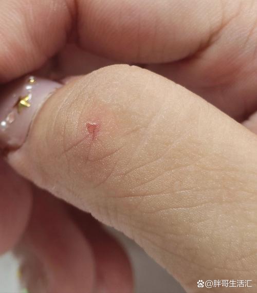 狗狗划破肠子症状表现,狗划破肠道有什么症状-第1张图片-后鲨宠物 狗狗划破肠子症状表现,狗划破肠道有什么症状-第1张图片-后鲨宠物